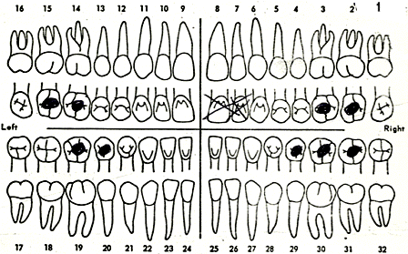 DOE, John 72-00006-S